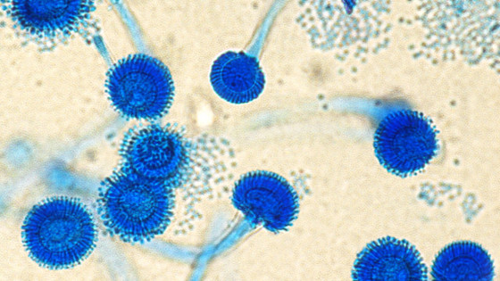 Phát hiện virus bên trong nấm có thể gây ra các bệnh nhiễm trùng chết người