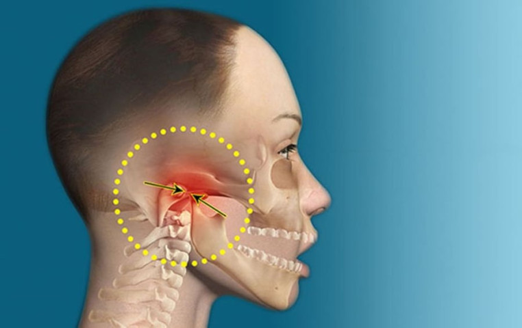 Rối loạn khớp thái dương hàm: Dấu hiệu cảnh báo và cách chữa trị
