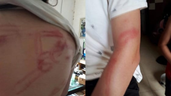 Từ hôm nay (4/9): Chồng đánh vợ có thể bị cấm tiếp xúc 4 ngày, công an địa phương giám sát 24/7