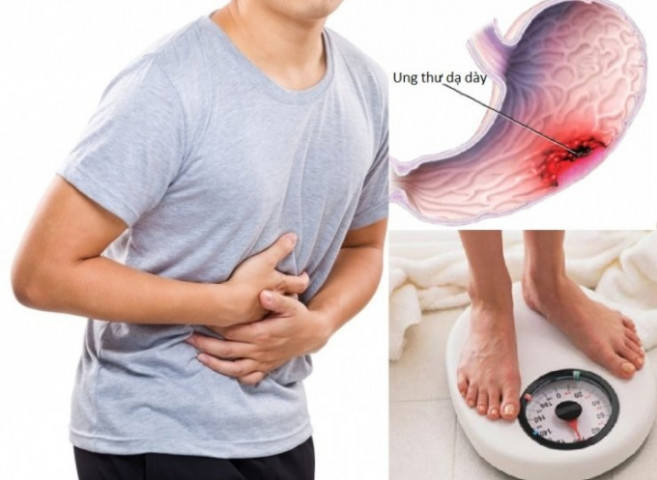 6 biến chứng cực kỳ nguy hiểm của viêm dạ dày cấp