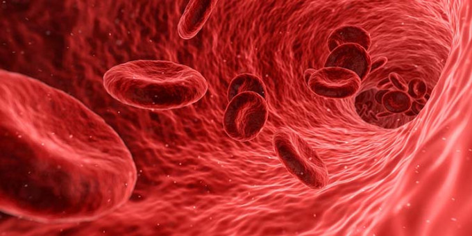 Các cách làm giảm nguy cơ bị tắc nghẽn động mạch và mức cholesterol cao