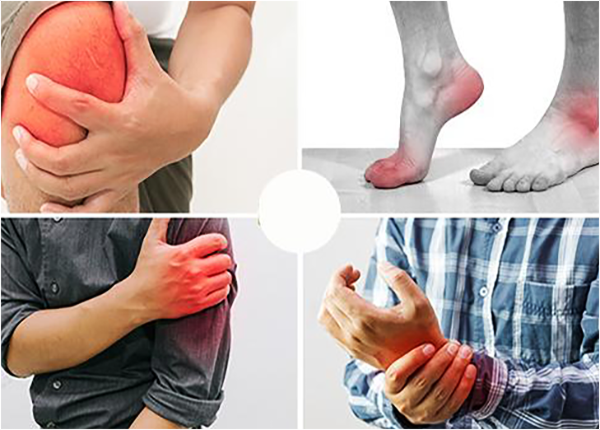 Những triệu chứng thường gặp ở bệnh viêm khớp phản ứng