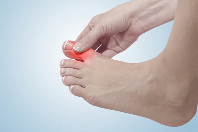 15 dấu hiệu của bàn chân cảnh báo nhiều bệnh tiềm ẩn