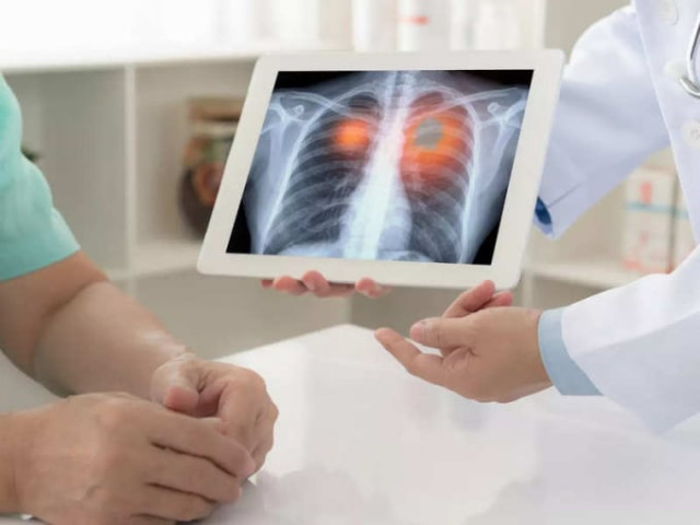 Các hoạt động gây hại phổi liên quan đến ung thư