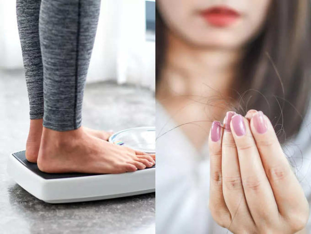 Giảm cân có thể dẫn đến rụng tóc
