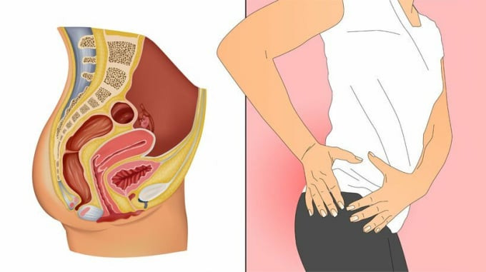 6 nguyên nhân thường gặp gây đau hậu môn