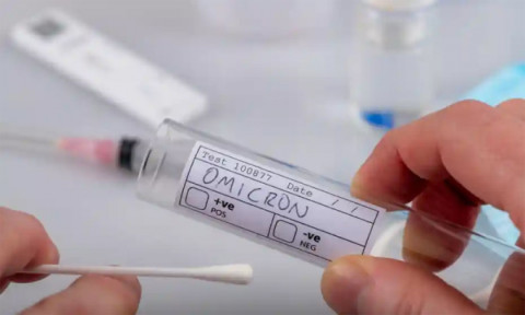 Thanh Hoá tăng cường công tác phòng, chống dịch, kiểm soát biến chủng mới Omicron của SARS-CoV-2