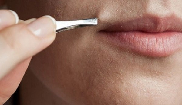 Làm sao để ngăn lông mặt phát triển?