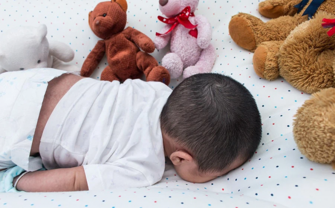 Cảnh báo hội chứng tử vong đột ngột ở trẻ nhỏ