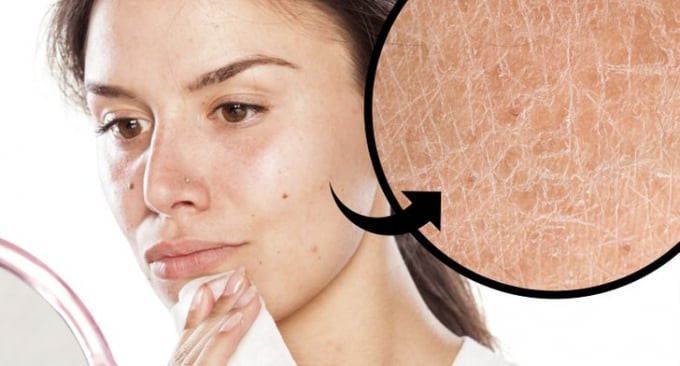 6 lý do khiến bông tẩy trang gây hại cho làn da
