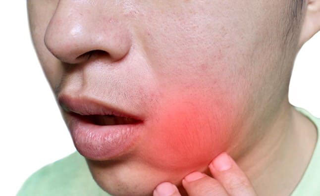 Hội chứng áp xe vô trùng là gì?