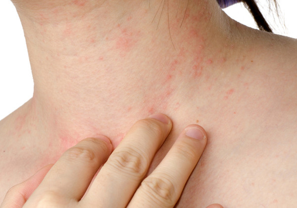 5 loại bệnh trẻ hay mắc khi vào mùa xuân