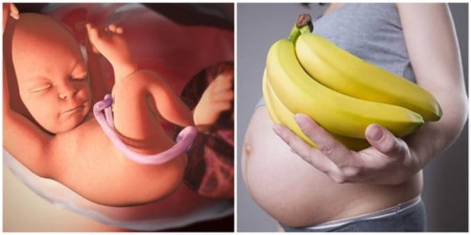 Những lợi ích của việc bà bầu ăn chuối khi mang thai