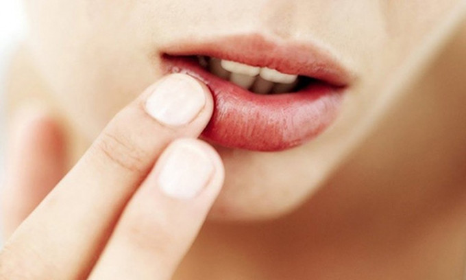 5 biện pháp giúp giảm thiểu các vấn đề về ung thư miệng