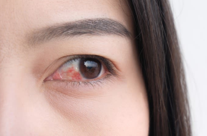 Các dấu hiệu nhỏ báo hiệu vấn đề sức khỏe nghiêm trọng