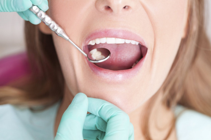 Vi khuẩn đường miệng có liên quan đến nguy cơ mắc bệnh huyết áp cao
