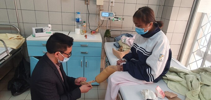 Cô gái được hỗ trợ "chân giả" do mắc nhiều bệnh phải cắt bỏ 2/3 cẳng chân