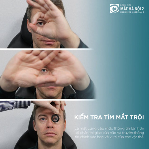 Cách kiểm tra tìm mắt trội
