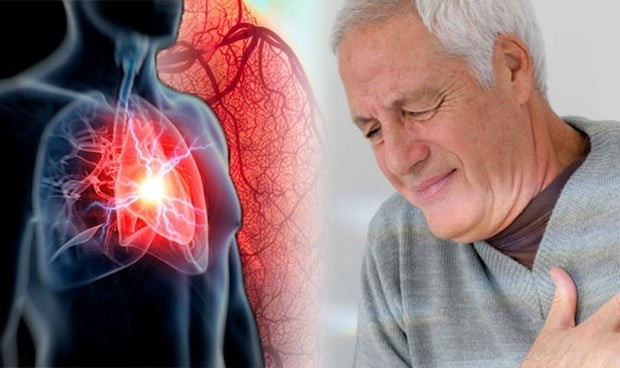 Những dấu hiệu nguy hiểm của bệnh suy tim bạn cần biết