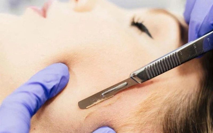Cạo lông mặt đang là xu hướng được nhiều người quan tâm