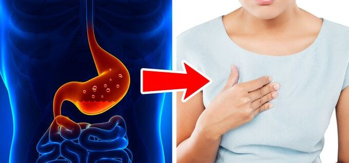 Tác hại của cà chua với sức khỏe