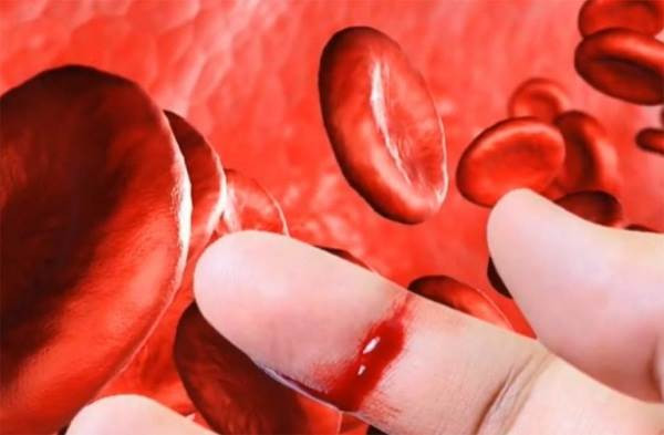 Bệnh máu khó đông cần tránh những thực phẩm nào?