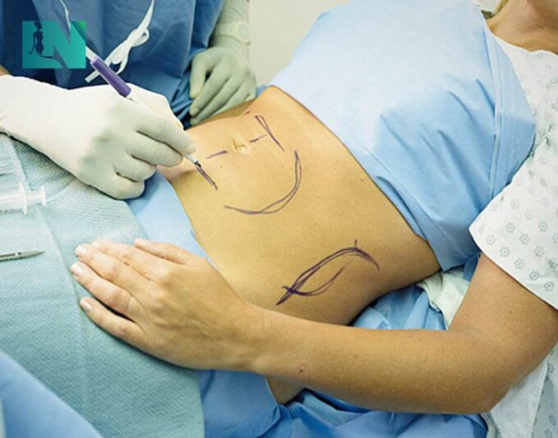 TP.HCM khởi tố và bắt tạm giam 3 đối tượng phẫu thuật hút mỡ bụng khiến 1 người tử vong