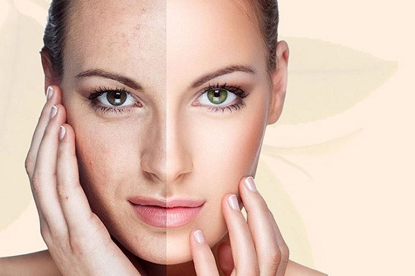 Cách giúp cải thiện độ săn chắc của làn da cho người trên 35 tuổi