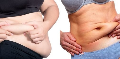 5 bài tập để loại bỏ da chảy xệ sau khi giảm cân