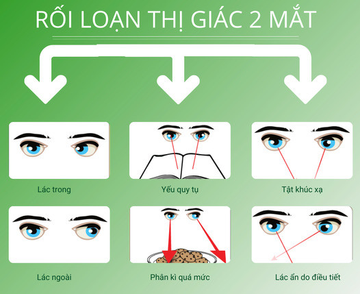 Phát hiện rối loạn thị giác hai mắt như thế nào?