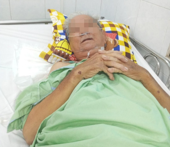 TP. HCM: Cụ ông nhiễm trùng nặng vì xương cá hú đâm thủng đại tràng