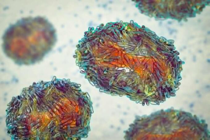 Phân tích bộ gen cho thấy virus đậu mùa khỉ đang đột biến nhanh bất thường