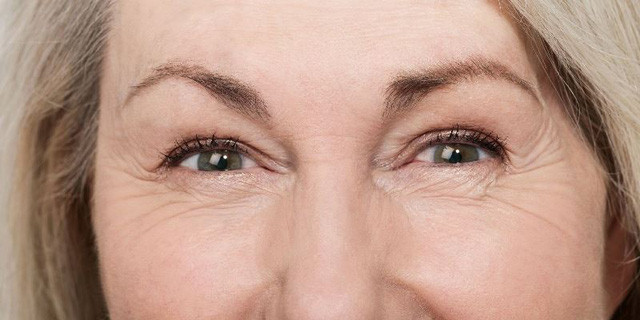 Cách đơn giản để giảm nếp nhăn ở khóe mắt