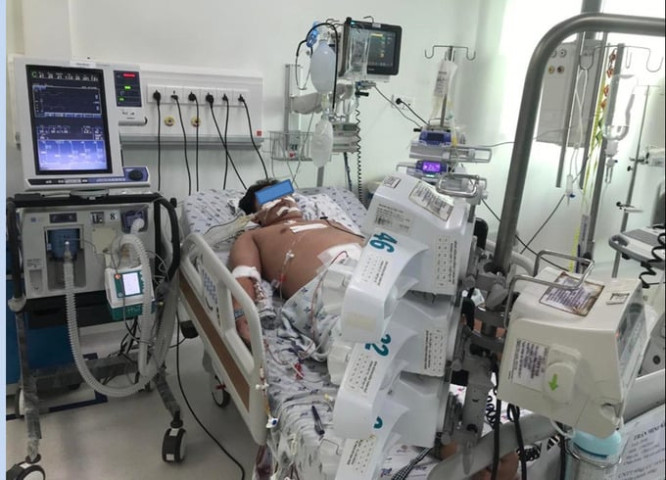 TP. HCM cứu sống nhiều trẻ bị sốc xuất huyết nặng, biến chứng suy hô hấp