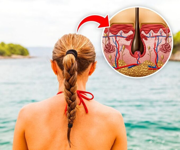 4 kiểu tóc khiến bạn bị đau đầu