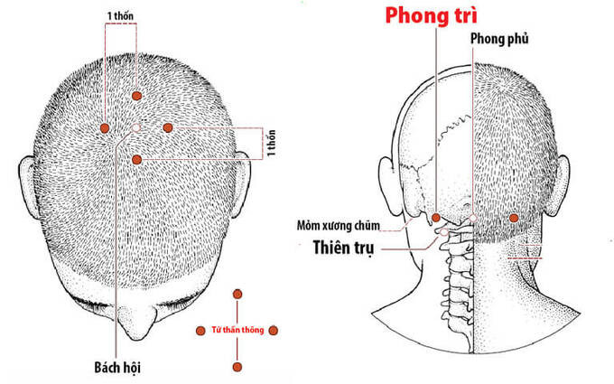 Bấm huyệt Tứ Thần Thông trị đau đầu, căng thẳng