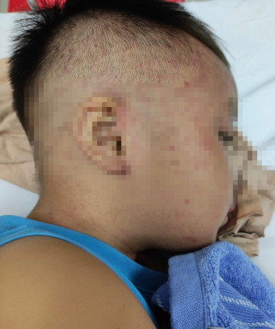 Hà Nội: Cấp cứu kịp thời bé trai 3 tuổi nghi bị bạo hành, nhốt trong tủ cấp đông