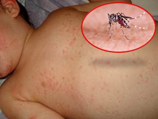 Bà Rịa-Vũng Tàu: Ghi nhận thêm 1 ca tử vong do sốt xuất huyết