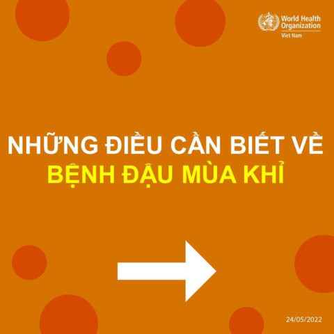 Hỏi đáp về bệnh đậu mùa khỉ