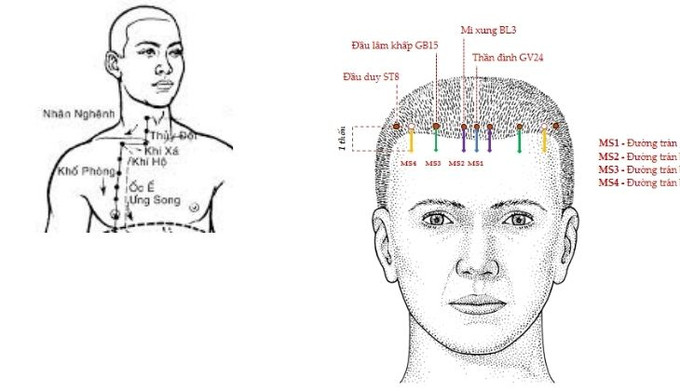 Tác dụng của châm cứu, bấm huyệt Đầu Duy đối với sức khỏe
