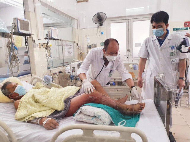 Hà Nội: Một bệnh nhân bị nhiễm vi khuẩn Vibrio vulnificus khiến chân bị hoại tử