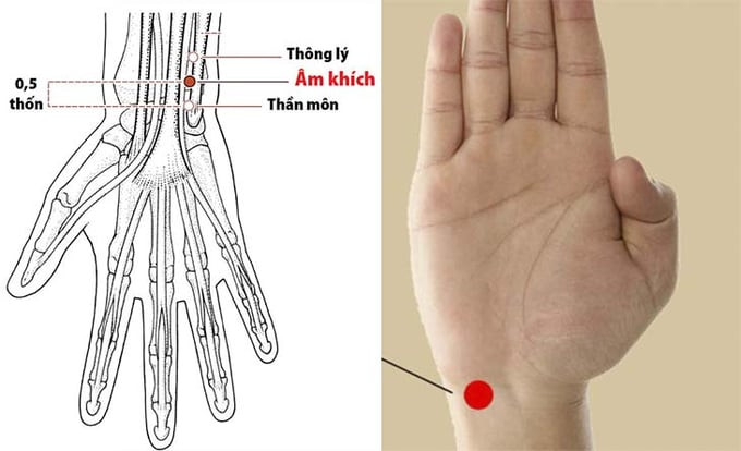 Tác dụng châm cứu, bấm huyệt Thần Môn cho sức khỏe