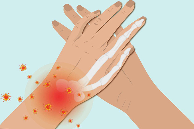 Hà Nội phẫu thuật thành công cho cụ ông 107 mắc bệnh ung thư da vùng mu bàn tay trái