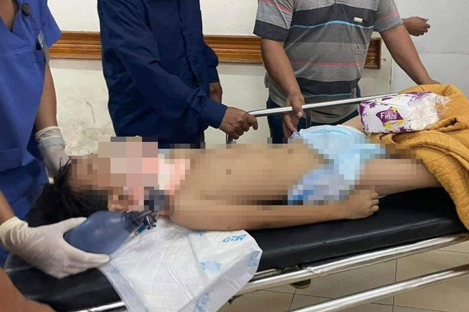 Hà Tĩnh: Một học sinh lớp 3 ngã từ lan can tầng 2 xuống đất nhập viện trong tình trạng nguy kịch