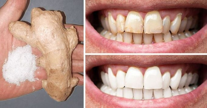 Một số mẹo làm trắng răng mà bạn có thể dễ dàng thực hiện tại nhà