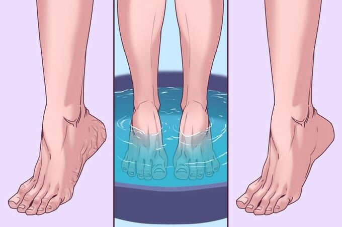 3 lợi ích mà ngâm chân bằng Listerine có thể mang lại