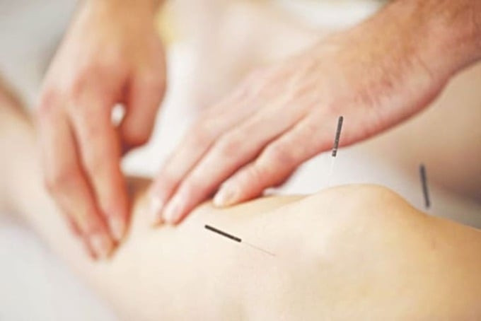 Tác dụng khi châm cứu, bấm huyệt Phi Dương cho sức khỏe