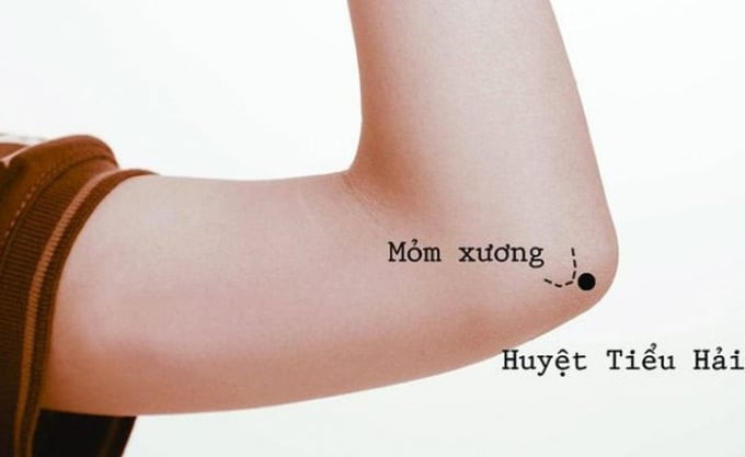 Châm cứu huyệt Tiểu Hải cải thiện chứng đau mỏi, co rút cơ tay, khuỷu tay