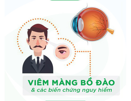 Viêm màng bồ đào và các biến chứng nguy hiểm