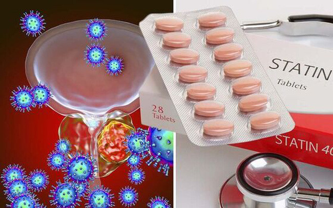 Nghiên cứu mới, thuốc điều chỉnh cholesterol có thể sử dụng để điều trị ung thư tuyến tiền liệt